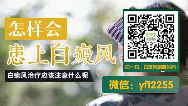 家长对小儿白癜风的前期症状知多少 家长对小儿白癜风的前期症状知多少