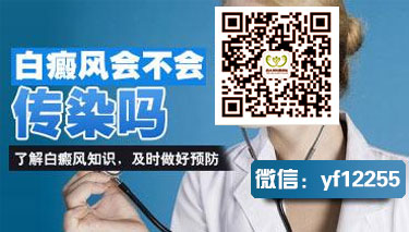 脸部早期白癜风的症状能看出来吗 脸部早期白癜风的症状能看出来吗