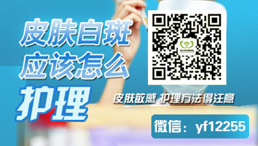 谁晓得白癜风周围疼裂了是好的症状吗 谁晓得白癜风周围疼裂了是好的症状吗