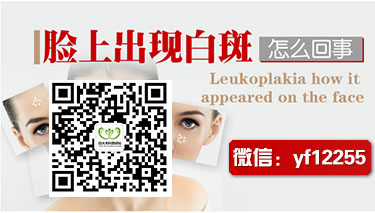 白癜风病图片_39健康网问医生wap版 白癜风病图片_39健康网问医生wap版