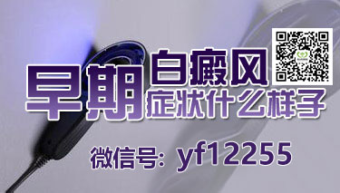 白癜风疾病出现的症状会不会有危害 白癜风疾病出现的症状会不会有危害