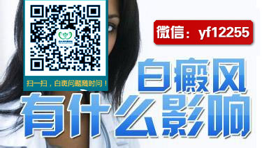 初期白癜风的症状是不是很不明显呀 初期白癜风的症状是不是很不明显呀