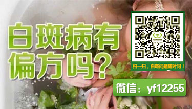 嘴唇上有白斑的情况下哪些症状属于白癜风 嘴唇上有白斑的情况下哪些症状属于白癜风