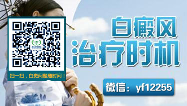 男性白癜风患者的表现症状有哪些 男性白癜风患者的表现症状有哪些