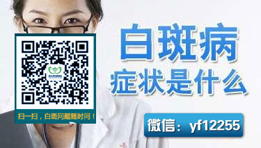 人们说这是白癜风的症状,请问是吗 人们说这是白癜风的症状,请问是吗