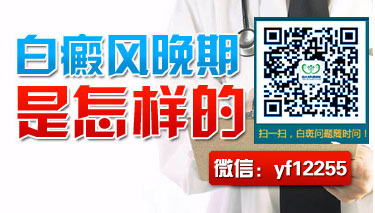 白癜风种类中节段型有什么表现呢 白癜风种类中节段型有什么表现呢