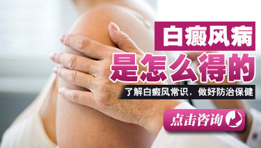 白癜风的原因 白癜风的原因