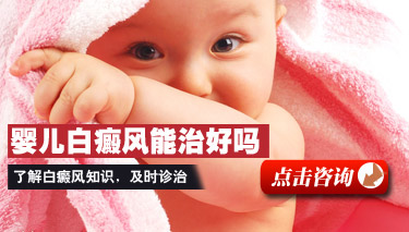 小儿白癜风的症状 小儿白癜风的症状
