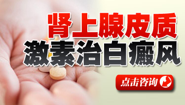 治疗白癜风药品 治疗白癜风药品