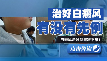白癜风能够治疗好吗 白癜风能够治疗好吗