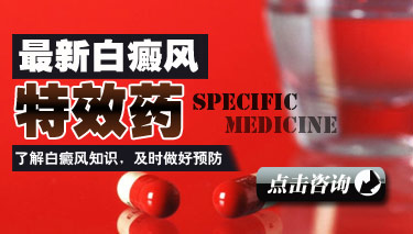 治疗白癜风较好的药膏 治疗白癜风较好的药膏