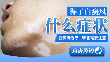 白癜风遮盖液哪种好