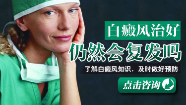 为什么白癜风会复发呢