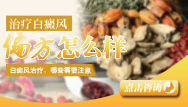 有治白癜风的偏方吗