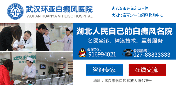 武汉看白癜风去哪里