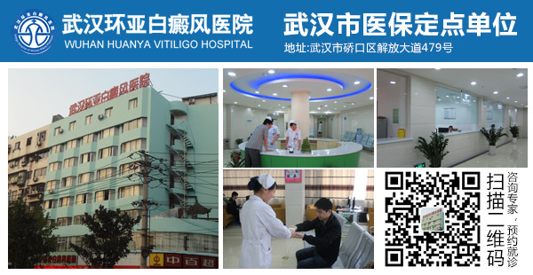 武汉看白癜风医院在哪里