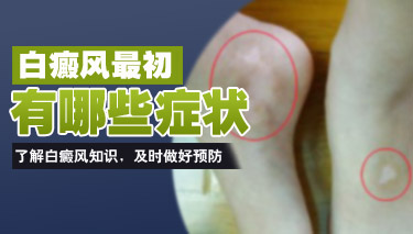 武汉环亚白癜风医院 武汉环亚白癜风医院