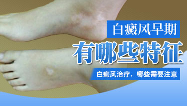 武汉环亚白癜风医院 武汉环亚白癜风医院