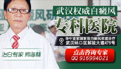 武汉环亚白癜风医院 武汉环亚白癜风医院