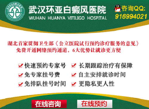 武汉环亚白癜风医院 武汉环亚白癜风医院