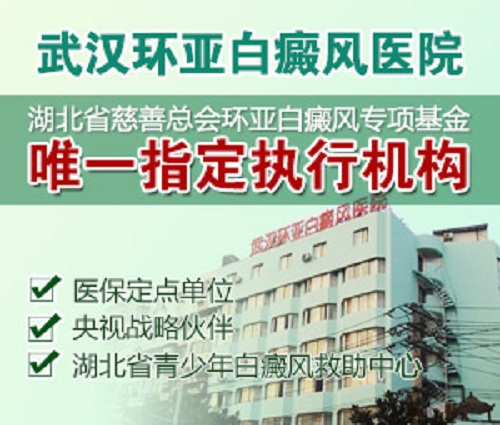 武汉环亚白癜风医院 武汉环亚白癜风医院