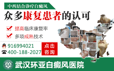武汉环亚白癜风医院 武汉环亚白癜风医院