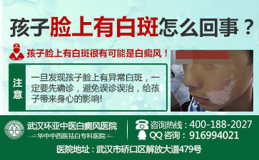 武汉白癜风治疗哪家好