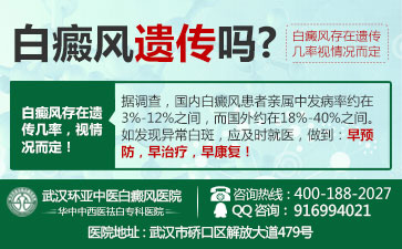 武汉白癜风治疗哪家医院较好