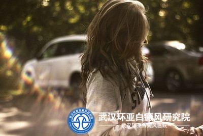白癜风的发病会不会与季节有关呢