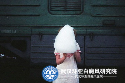 女性癜风得白癜风的病因如何而来呢