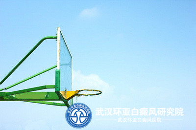 脸上长白癜风的原因是什么呢