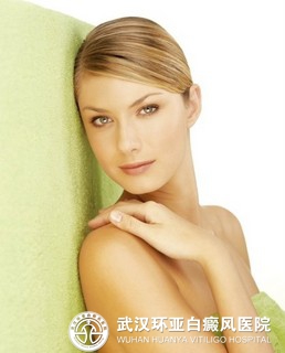 女性患上白癜风要怎么办